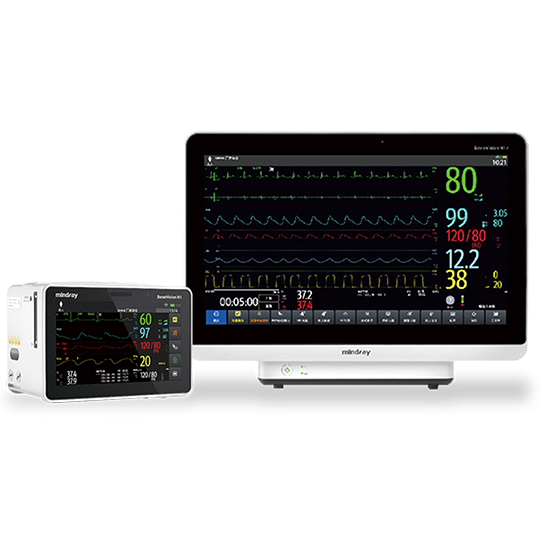 ECG Monitor