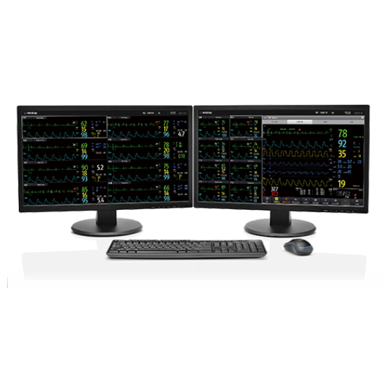 central monitoring system